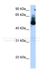 ARP38247_T100 - SS-A / Ro52 / TRIM21