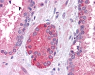 ARP38253_P050 - STAT3