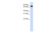 ARP38253_P050 - STAT3