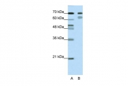 ARP38267_T100 - TCF3 / E2A