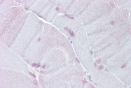 ARP38279_P050 - Thyrotroph embryonic factor (TEF)