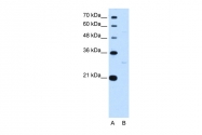 ARP38279_P050 - Thyrotroph embryonic factor (TEF)