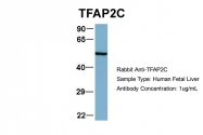 ARP38284_T100 - AP2-gamma / TFAP2C