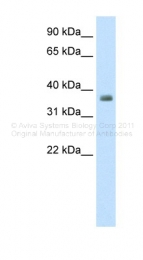 ARP38303_P050 - Tristetraproline (TTP)