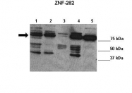 ARP38361_T100 - ZNF282