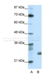 ARP38392_T100 - SAP30