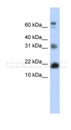 ARP38401_P050 - BUD31 / EDG2