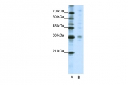 ARP38444_T100 - MED27