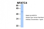 ARP38493_P050 - NFATc4 / NFAT3