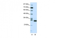ARP38525_T100 - CDK5