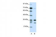 ARP38526_T100 - CDK5