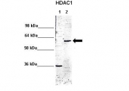 ARP38530_T100 - HDAC1