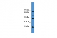 ARP38572_P050 - ASCL2