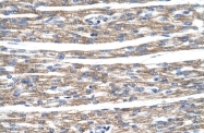 ARP38585_T100 - DLX5