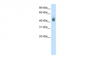 ARP38648_T100 - SOX3
