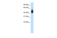 ARP38649_T100 - SOX3