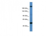 ARP38661_P050 - TCF20 / SPBP