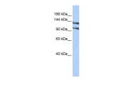 ARP38684_P050 - RBM5 / LUCA15