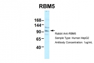 ARP38684_P050 - RBM5 / LUCA15