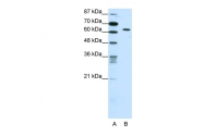 ARP38693_T100 - SMAD1