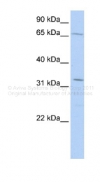 ARP38734_P050 - TRIM22 / RNF94