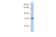 ARP38735_P050 - CITED2
