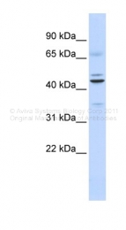 ARP38769_P050 - UBID4 / DPF2