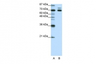 ARP38799_T100 - TRIM16