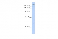 ARP38831_P050 - NFAT5
