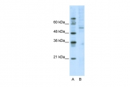 ARP38869_T100 - ATF7