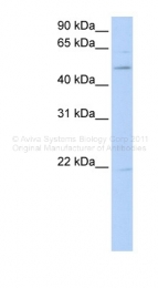 ARP38879_P050 - ROR-beta / RORB