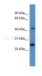 ARP38904_P050 - TFDP1
