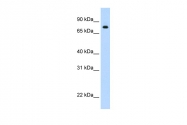 ARP38933_P050 - STAT1