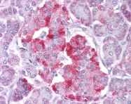 ARP38933_P050 - STAT1