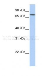 ARP38952_P050 - TRIM29 / ATDC