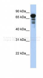 ARP38953_P050 - TRIM29 / ATDC