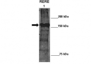 ARP38954_P050 - RERE