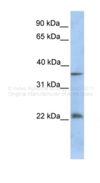 ARP38973_P050 - RYBP