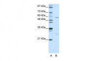 ARP38976_P050 - HBP1
