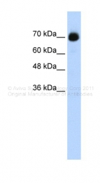 ARP39110_T100 - CpG-binding protein