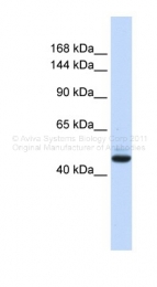 ARP39124_P050 - GREB1