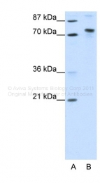 ARP39144_T100 - TOX4