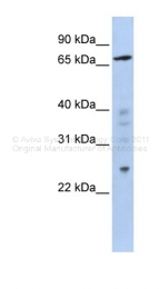 ARP39154_P050 - ZNF510