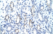 ARP39254_T100 - GTF2IRD1 / CREAM1