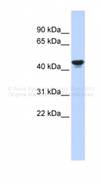 ARP39317_P050 - HIF1AN / FIH1