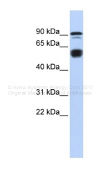 ARP39322_P050 - Bcl-11A