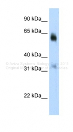 ARP39325_P050 - JMJD2D / KDM4D