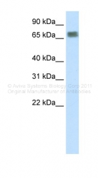 ARP39337_T100 - ZFP64 (isoforms 1 and 2)