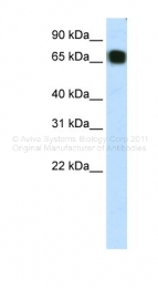 ARP39338_T100 - ZFP64 (isoforms 1 and 2)