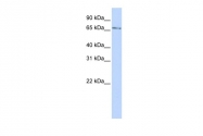 ARP39345_P050 - Kelch-like protein 26